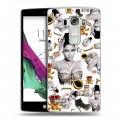 Дизайнерский пластиковый чехол для LG G4 S Ники Минаж