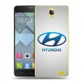Дизайнерский пластиковый чехол для Alcatel One Touch Idol X Hyundai