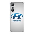 Дизайнерский силиконовый с усиленными углами чехол для Infinix Hot 20 Hyundai