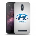Дизайнерский силиконовый чехол для Homtom HT17 Hyundai