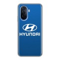 Дизайнерский силиконовый чехол для Huawei Nova Y70 Hyundai