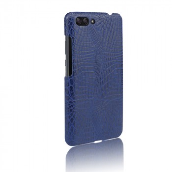 Чехол задняя накладка для Asus ZenFone 4 Max с текстурой кожи Синий